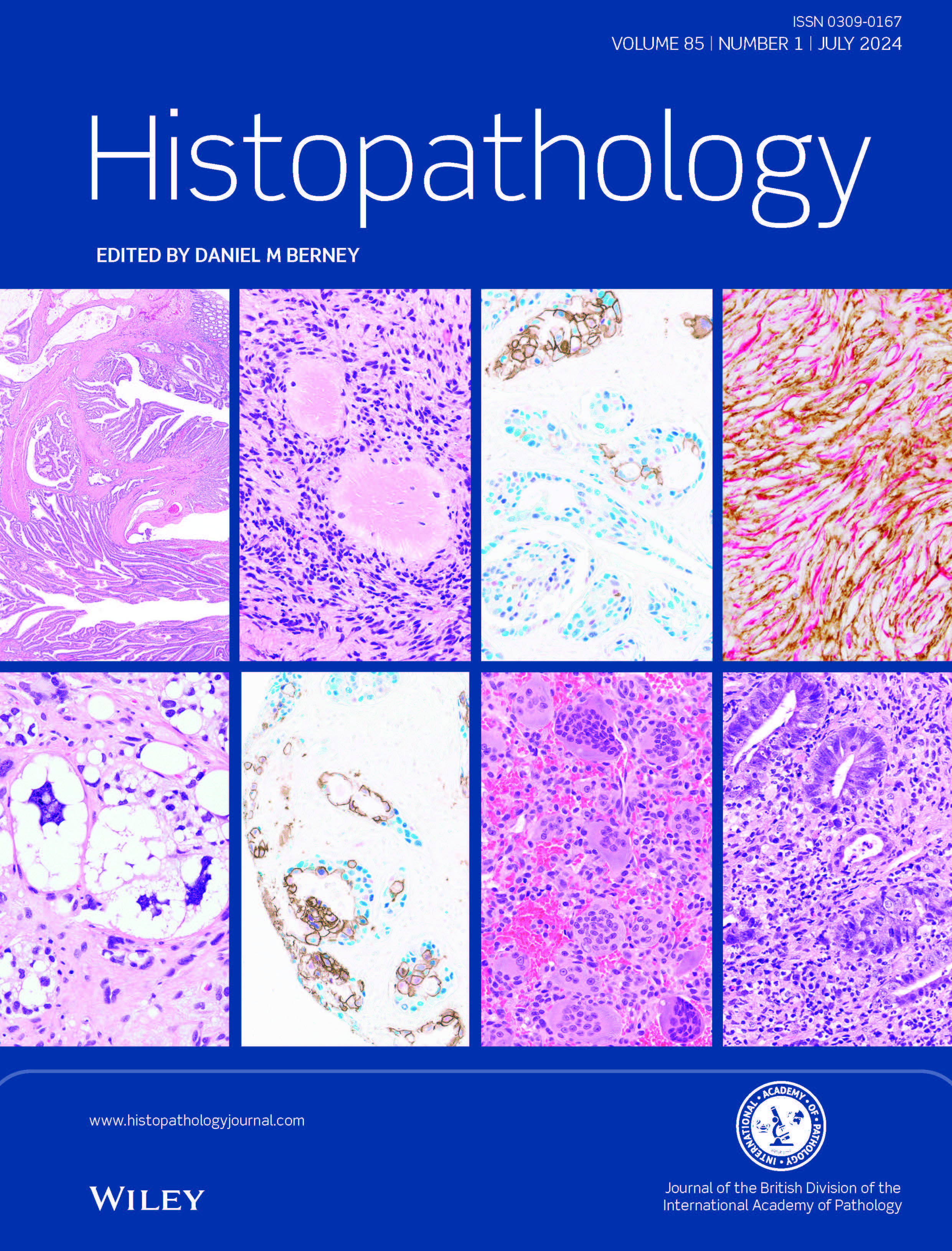 Histopathology Journal July 2024 